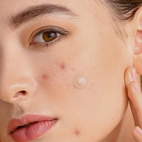 SKINNY Pimple Patch Kit