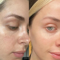 MEDICUBE Glass Glow Skincare Kit (8 pcs)™